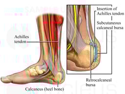 Achilles Tendon