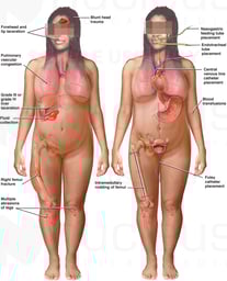 Side by Side Female Figures Comparing Post-accident Injuries and Medical Treatments