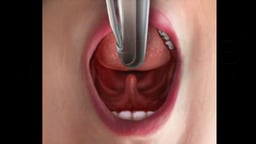 Laryngoscope Opening Airway