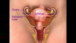 Hysterectomy Procedures - Abdominal, Vaginal and Laparoscopic