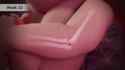 Fetal Arm Bones at Week 32 of Pregnancy