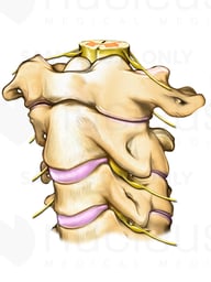 Oblique view of C1-C3 Vertebrae with Spinal Cord