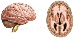 Anatomy of the Brain