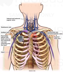 Venous Anatomy of the Upper Thorax