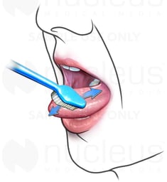 Brushing Your Tongue