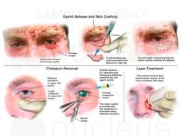 Multiple Surgeries on Face