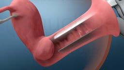 Speculum-Assisted Visualization of the Cervix