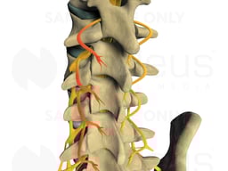 Inflammation of Left Lumbar Nerves