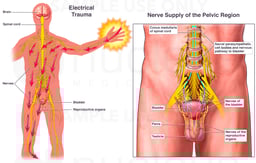 Electrical Shock Trauma Causing Damage to Reproductive Nerves