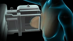 Mammogram Procedure