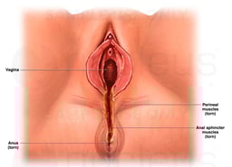 Fourth Degree Vaginal Tear