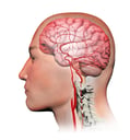 Arteries of the Brain
