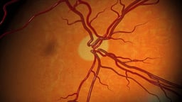 Fundoscopic View of the Optic Disc and Retinal Vasculature