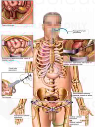 Multiple Operations and Procedures