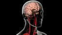 Arteries of the Brain