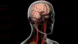 Arteries of the Brain