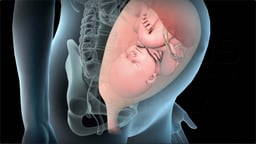 What is Stage 1 of Labor?