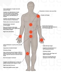 Multiple Surgical Procedures