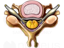 Cervical Vertebra with Spinal Cord: Superior View