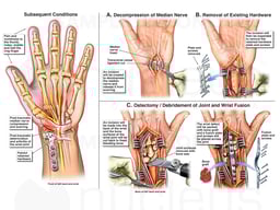 Future Surgical Procedures
