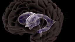 Ventricles of the Brain and CSF Flow