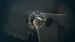 Temporomandibular Joint with Articular Disc