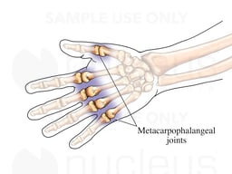 The Metacarpophalangeal Joints