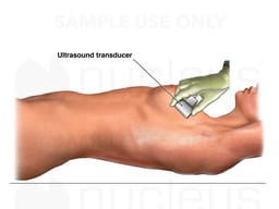 Breast Ultrasound