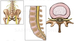 Anatomy of Lumbar Spine