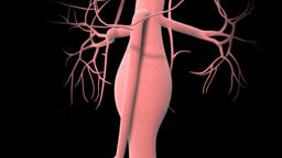 Abdominal Aortic Aneurysm