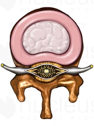 Lumbar Vertebra with Spinal Cord, Superior View