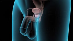 "Watchful Waiting" for Benign Prostatic Hyperplasia (BPH)