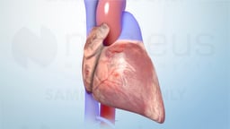 Managing Heart Failure