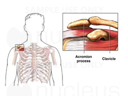 Bone Spur in the Shoulder: Normal Anatomy