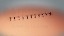 Incision Care Discharge Instructions