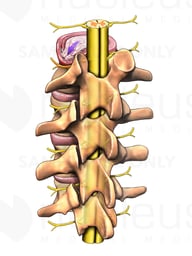 Lumbar Vertebrae with Spinal Cord, Posterior/Lateral View