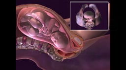 Childbirth - Normal Vaginal Delivery