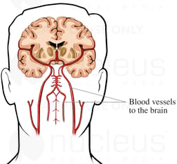 Blood Supply to the Brain