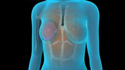 Breast Reconstruction