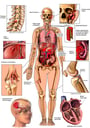 Injuries to the Head, Knee, Neck, Elbow, Heart and Spleen
