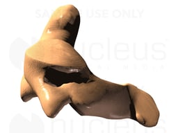 C2 Vertebra, Lateral View