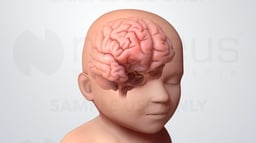 Understanding Epilepsy in Children