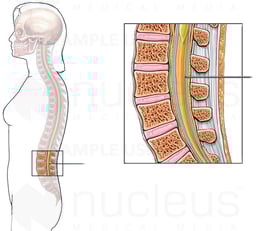 Spinal Tap - Lumbar Puncture Method