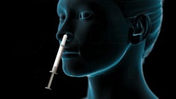 Nasal Spray Administration