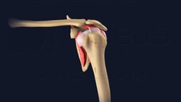 Lateral View of Left Rotator Cuff