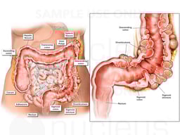 Anterior view of a female abdomen
