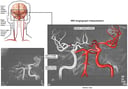 MRI Angiograph of the Head and Neck