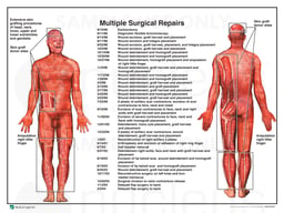 Total Body Burn Injuries with Multiple Surgical Repairs