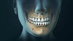 Side-to-Side Movement of Temporomandibular Joint (TMJ)