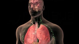 Lung Cancer Staging: Non-small Cell